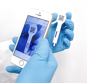 BIO K 399 - SmartStrips IgG - blood